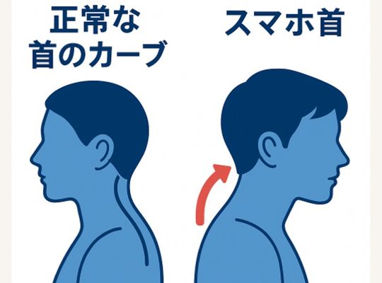 ストレートネック